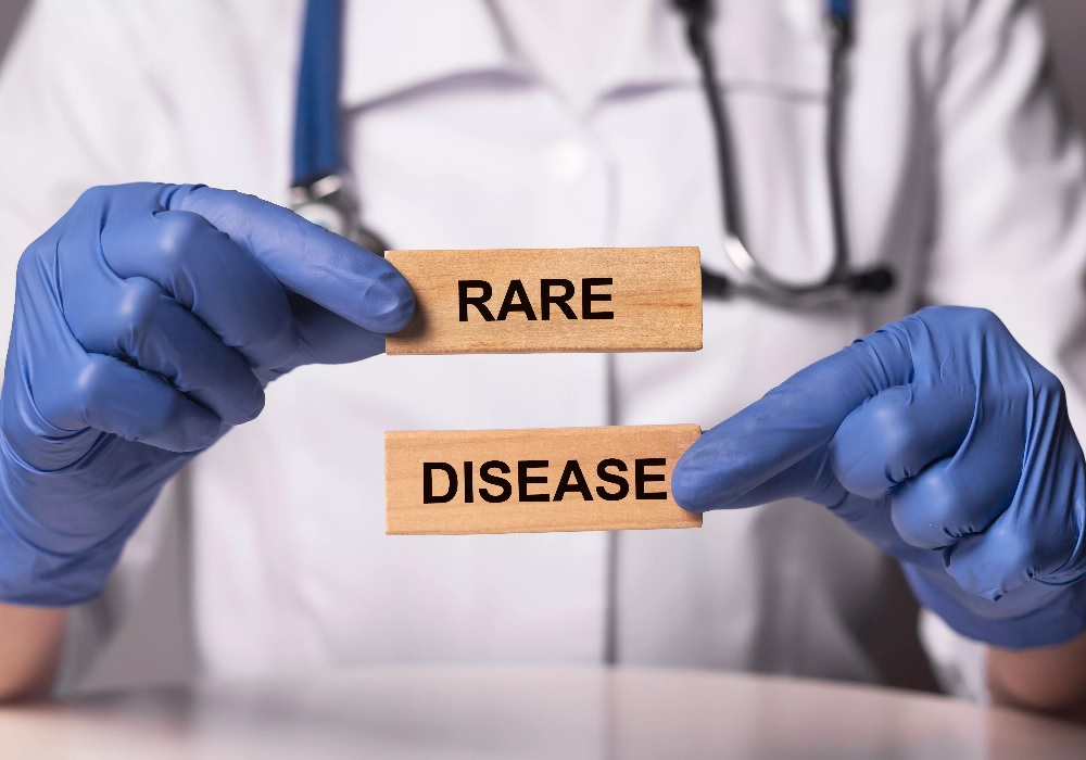 Person holding a some blocks that say rare disease