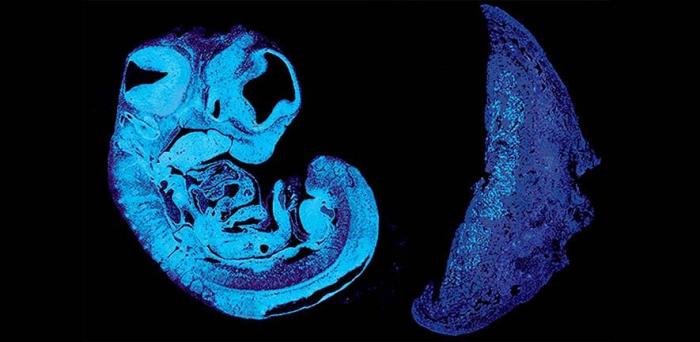   Section of mouse fetus and placenta  Credit: Ionel Sandovici