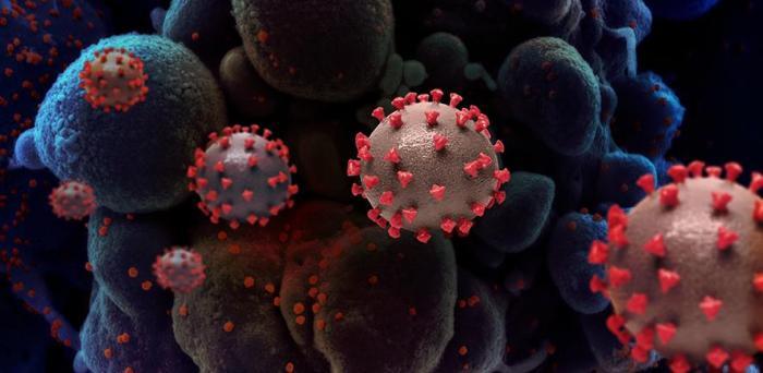   Creative rendition of SARS-COV-2 virus particles  Credit: NIH Image Gallery