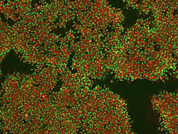 IPSC culture stained for markers nanog and TRA160