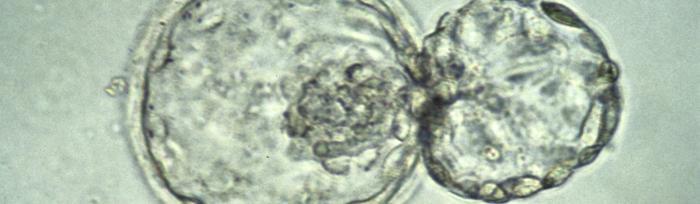Human Blastocyst hatching_ credit K Hardy_CC BY 4.0