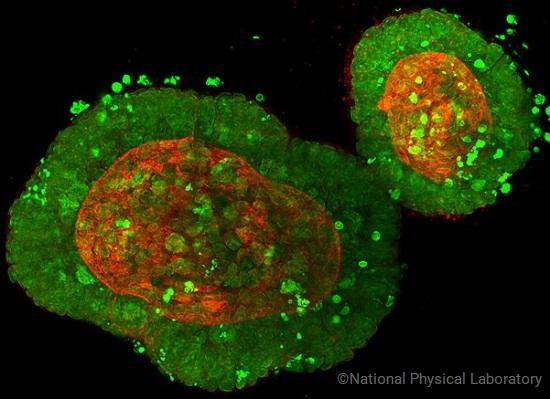 Colorectal cancer organoids stained with Hoechst (blue/green) and Phalloidin (yellow/red). Image provided by Cellesce, copyright National Physical Laboratory. 