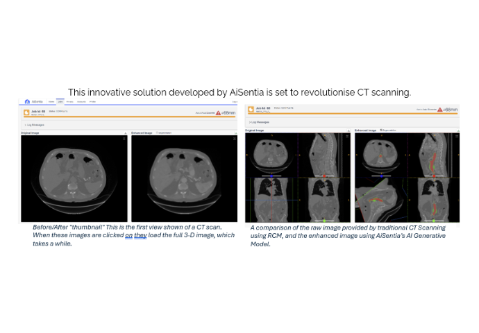 AiSentia CT Scanning