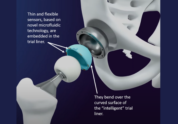 an exploded view of the thin and flexible sensors and the “intelligent” trial liner