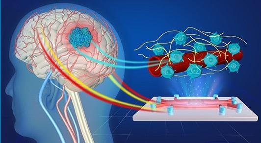   Artist's impression of the 3D microvessel-on-a-chip device for the study of glioblastoma.  Credit: Yuanyuan Bei