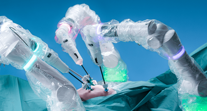 The Versius® Surgical Robotic System