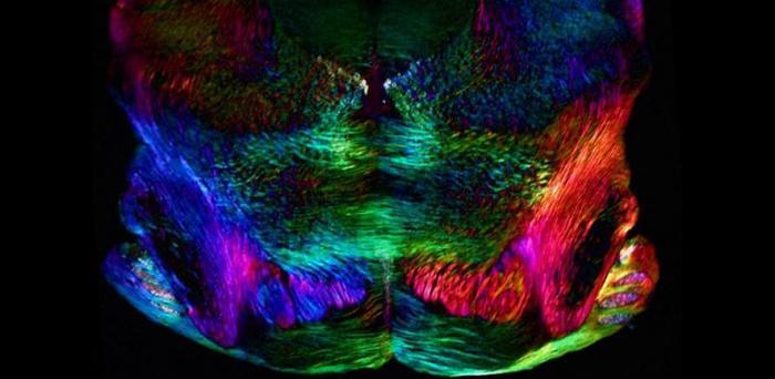 Spatially oriented neurons (mouse brain)  Credit: Michael Shribak, Marine Biological Laboratory, Woods Hole, MA
