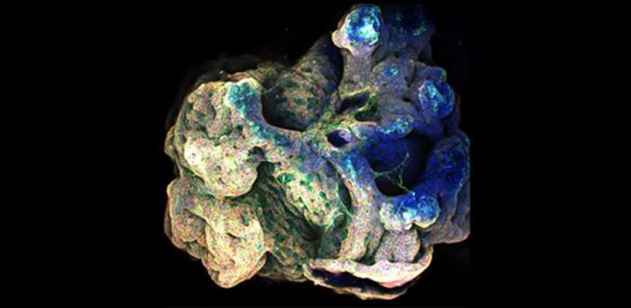   3D projection of a multi-organoid aggregate  Credit: Catherine Dabrowska