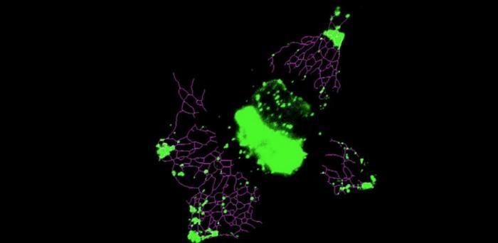   Inducing lysosome (green) anterograde motion with light leads to a rapid and significant extension of ER network (magenta).  Credit: Clemens Kaminski